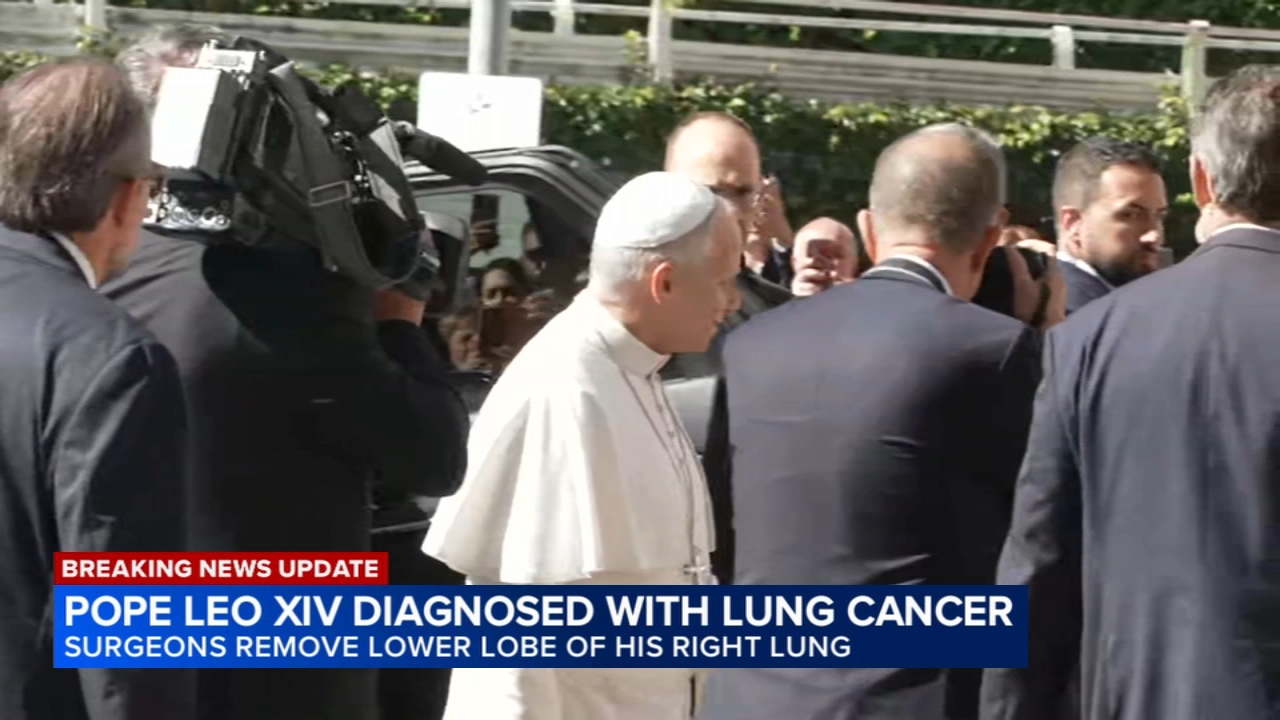 Pope surgery update: Vatican says Pope Leo XIV has lung cancer and the lower lobe of his right lung was removed
       — ABC 7 Bay Area, Sunnyvale Community news
