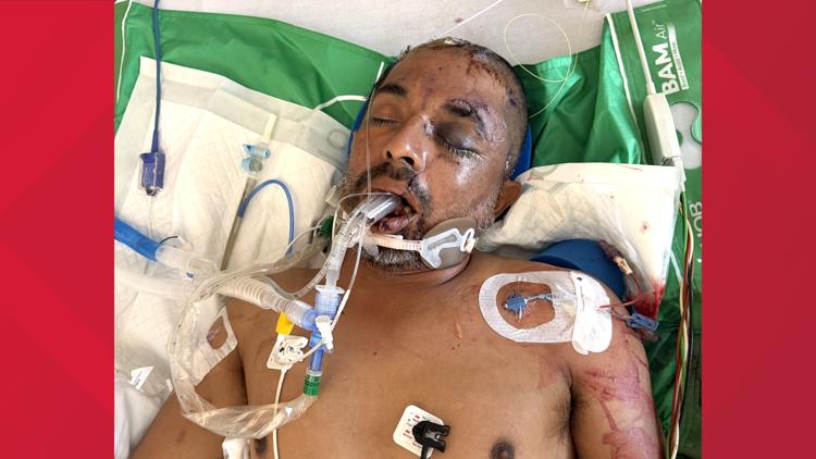 University Hospital asks for help identifying unconscious patient hit by truck Saturday evening — KENS 5 (San Antonio), Sunnyvale Health news