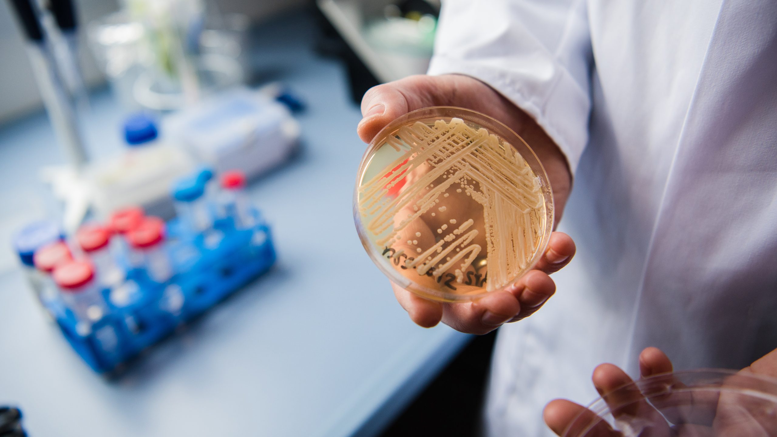 New study reveals why dangerous fungus is so difficult to treat — KTVU FOX 2 Bay Area, Sunnyvale Community news